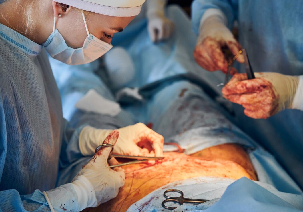 Advanced Laparoscopic Surgery
